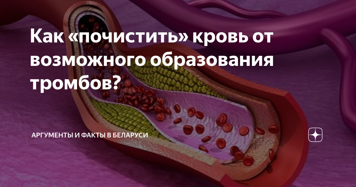 Как «почистить» кровь от возможного образования тромбов? | Аргументы и ...