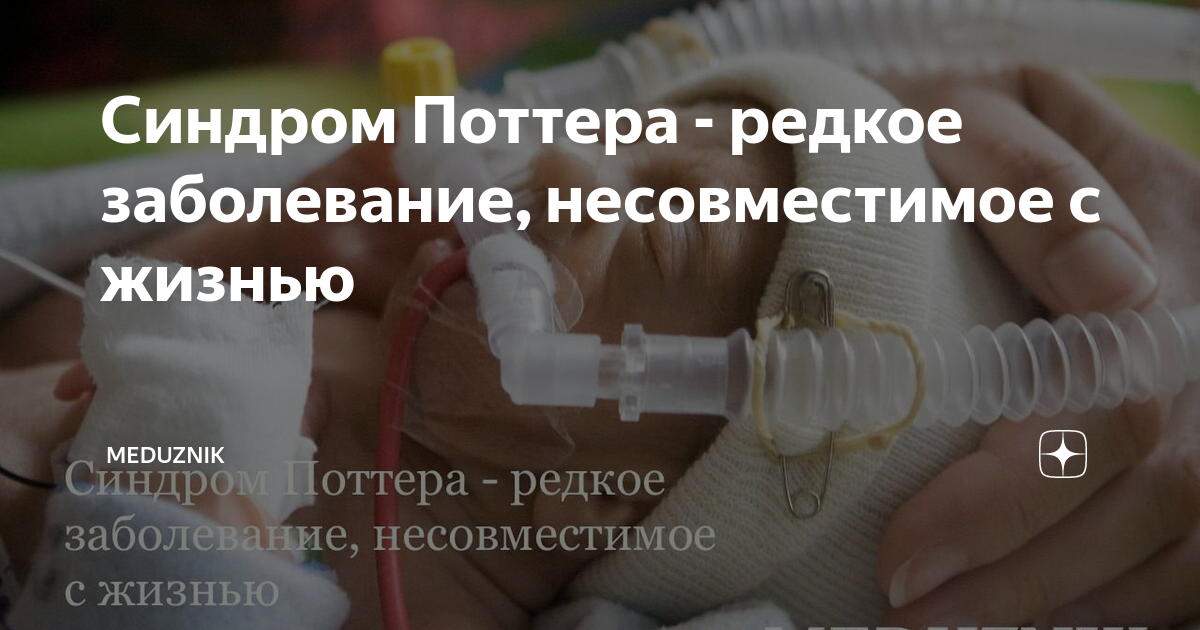 Симптомы терминальной стадии заболевания. Сортировочные группы. Раны несовместимые с жизнью. Заболевание несовместимое с жизнью. Заболевание несовместимое с жизнью.