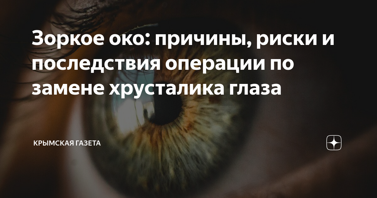 Зоркое око фильм