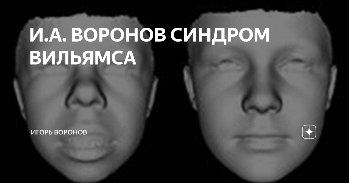 И.А. ВОРОНОВ СИНДРОМ ВИЛЬЯМСА | Игорь Воронов | Дзен