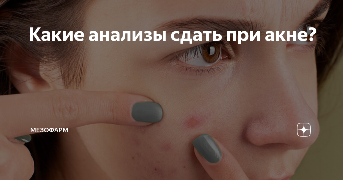 какие анализы сдать при зппп