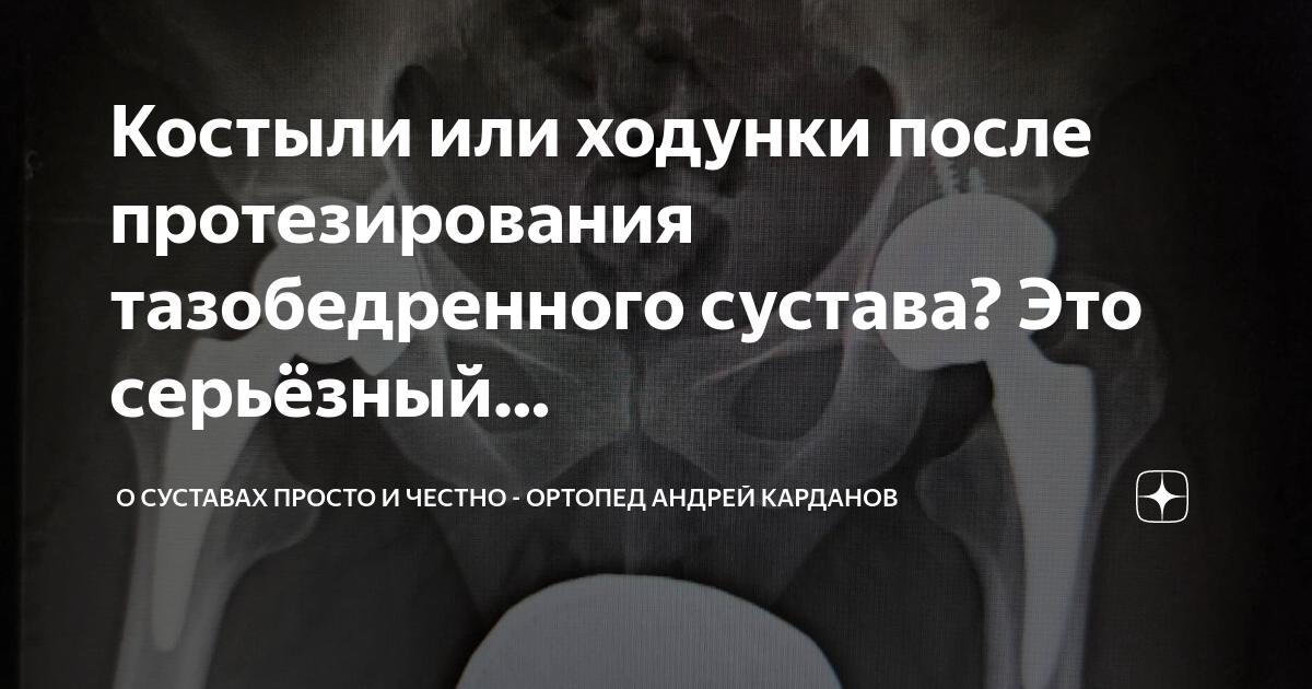 восстановление после протезирования тазобедренного сустава