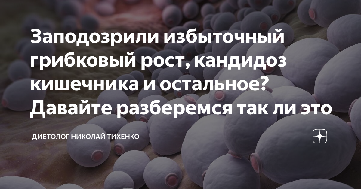 Кандидоз кишечника: симптомы, причины, лечение, профилактика