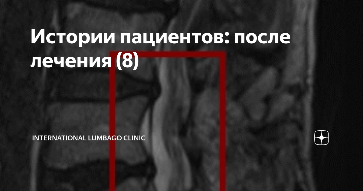 Истории пациентов. Схема истории болезни терапия. Книга истории пациентов. Медицинская карта стационарного больного (история болезни) (ф. Истории пациентов.