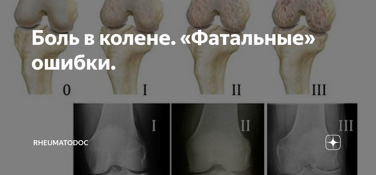 колющая боль справа в ребрах