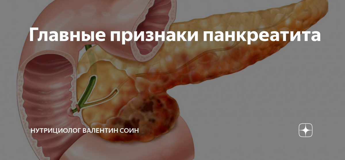 Главные признаки панкреатита | Школа славянского целительства "Древо ...