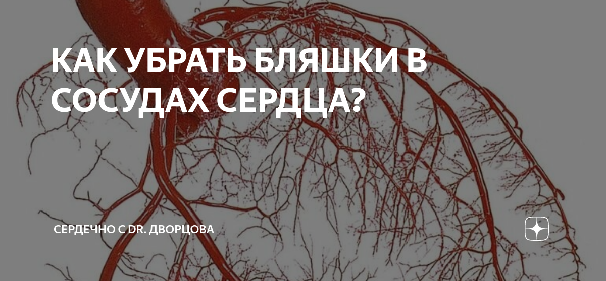 КАК УБРАТЬ БЛЯШКИ В СОСУДАХ СЕРДЦА? | Сердечно с dr. Дворцова | Дзен