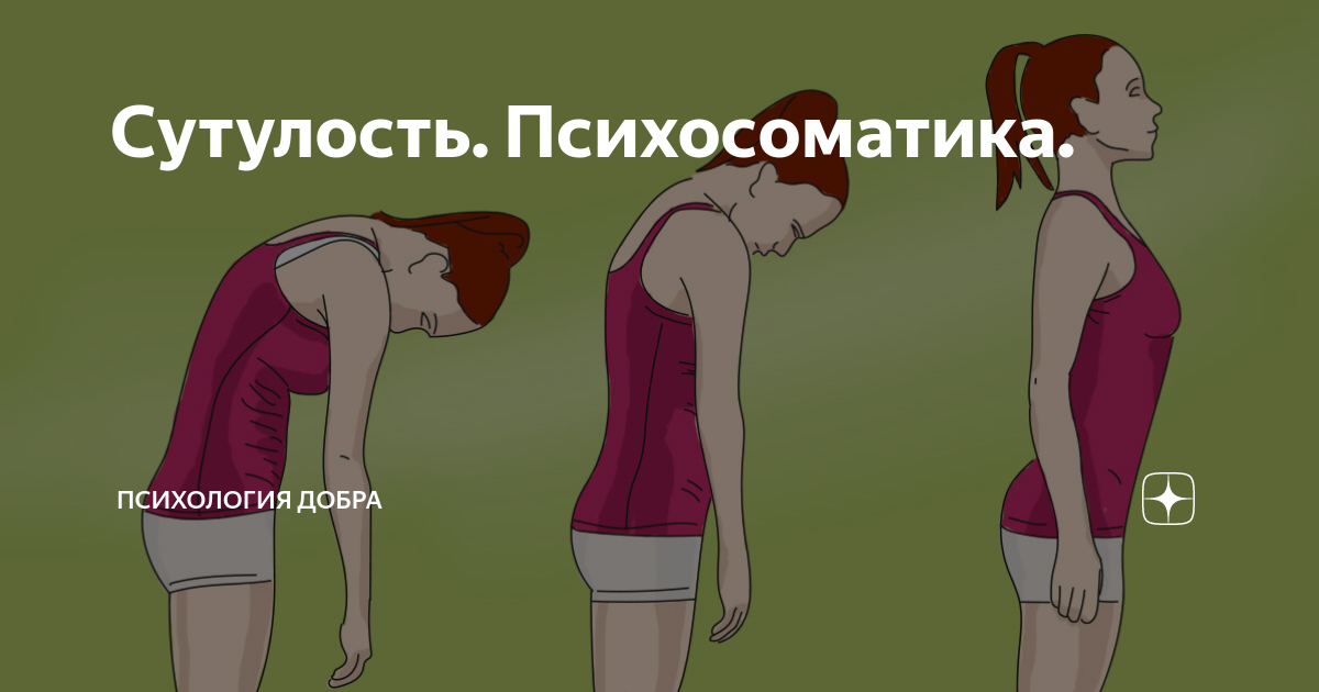 Округлые плечи. Сутулость фото девушек. Осанка психосоматика. Психосоматика сутулость у женщин. Осанка человека при ходьбе.