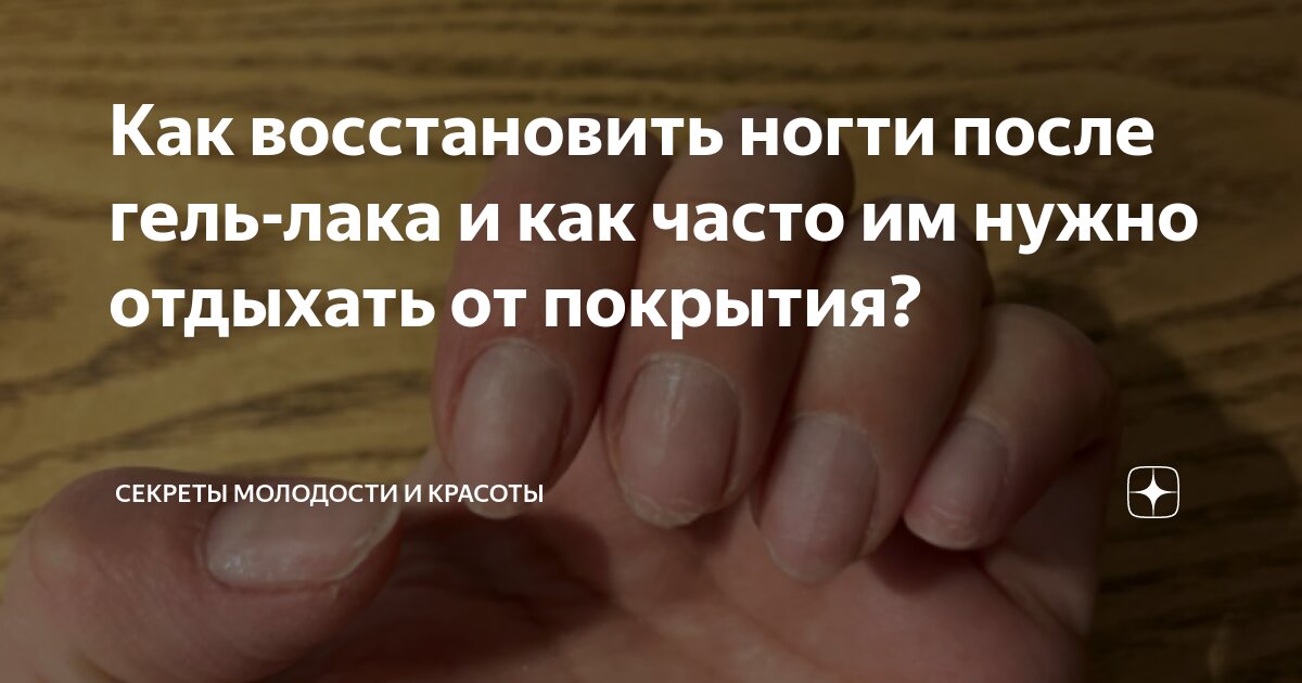 Нужно ли ногтям отдыхать. Как часто надо делать маникюр. Срок носки покрытия на ногтях. Ногти подростков после гель лака. Покрытие после снятия гель лака.