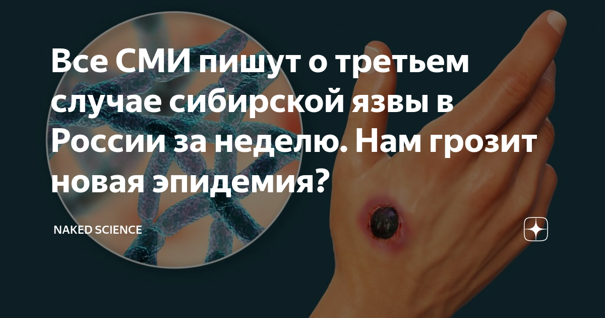 Все СМИ пишут о третьем случае сибирской язвы в России за неделю. Нам ...