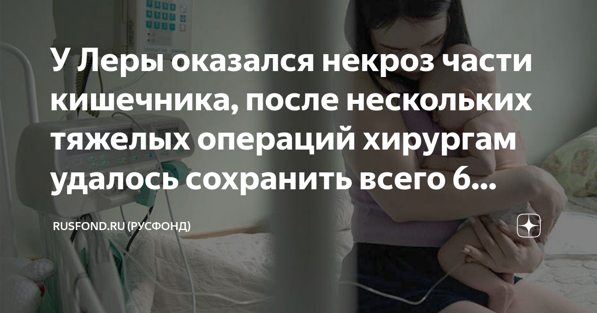 У Леры оказался некроз части кишечника, после нескольких тяжелых ...
