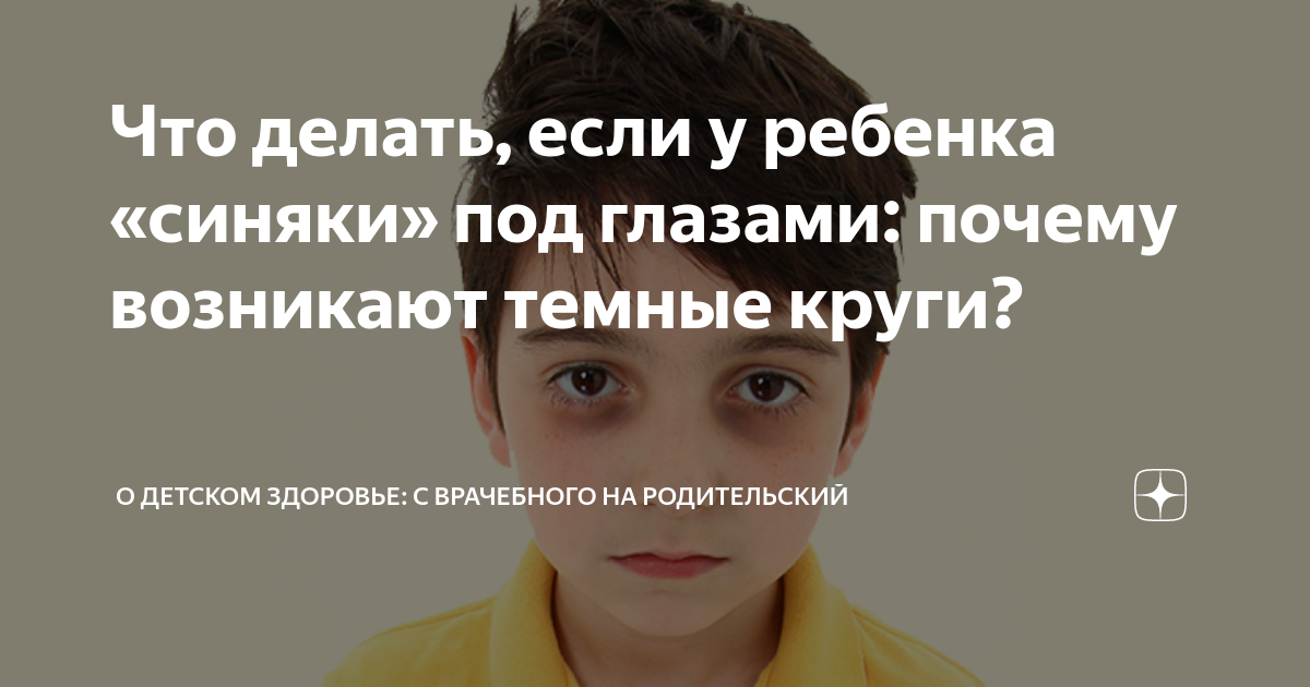 Что делать, если у ребенка «синяки» под глазами: почему возникают темные круги?