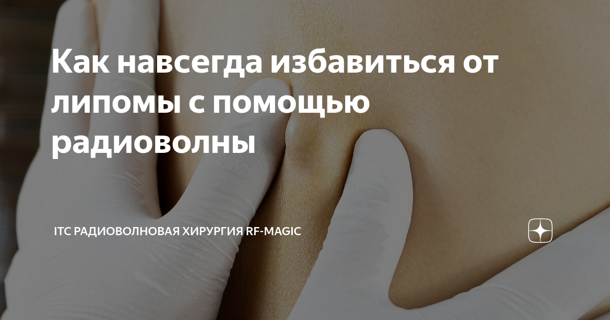 Как навсегда избавиться от липомы с помощью радиоволны | Корейский ...