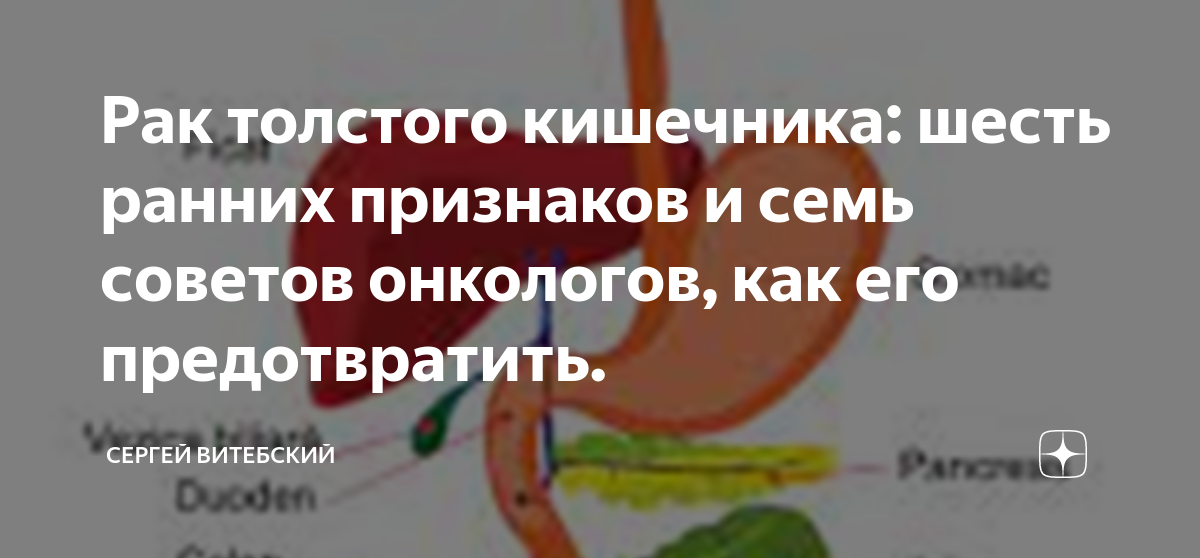 Рак толстого кишечника: шесть ранних признаков и семь советов онкологов ...