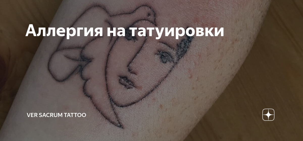 Аллергия на пигменты тату. Чем опасна аллергическая реакция на краски татуировки?