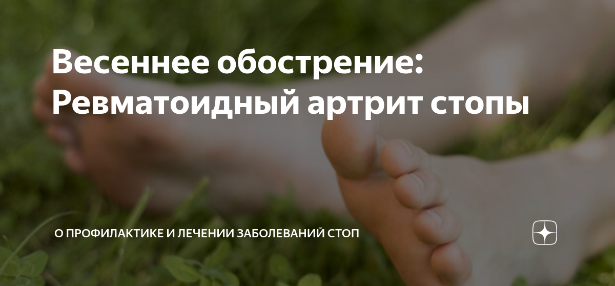 Весеннее обострение: Ревматоидный артрит стопы | О профилактике и ...