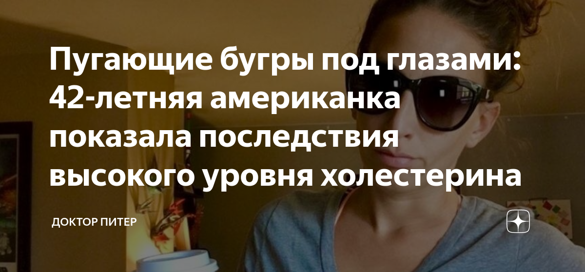 Пугающие бугры под глазами: 42-летняя американка показала последствия ...