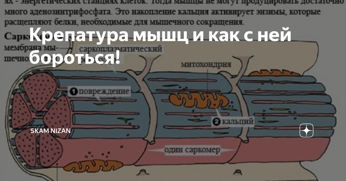 Крепатура что это. Крепатура мышц. Крепатура. Крепатура почему. Свидетельствует ли крепатура о росте мышц.