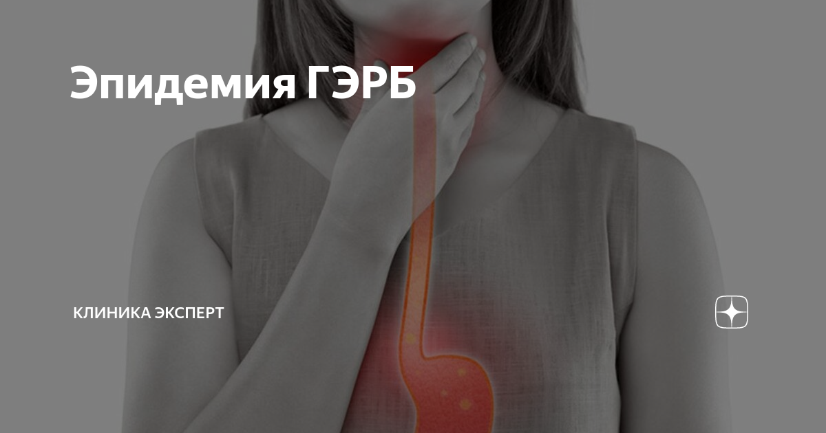 Эпидемия ГЭРБ | Клиника ЭКСПЕРТ - Гастро-гепатоцентр | Дзен