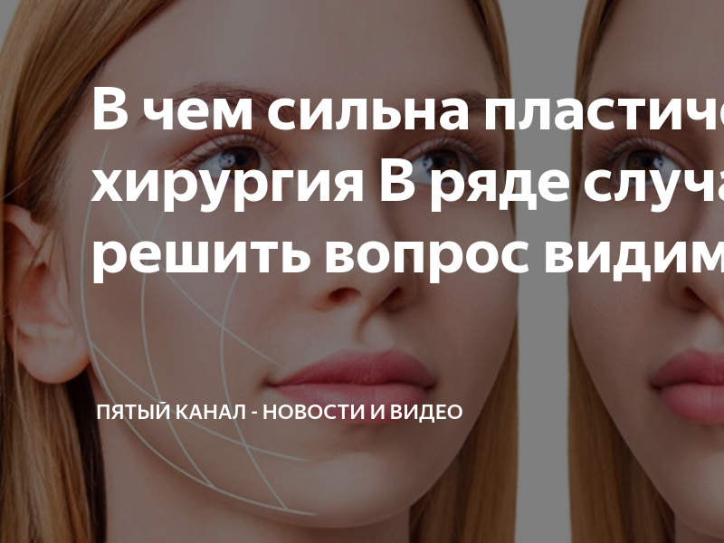 Пластический размер. Признаки головной боли. Покраснение лица вечером. Системная красная волчанка симптомы. Почему горит лицо у женщин без температуры.