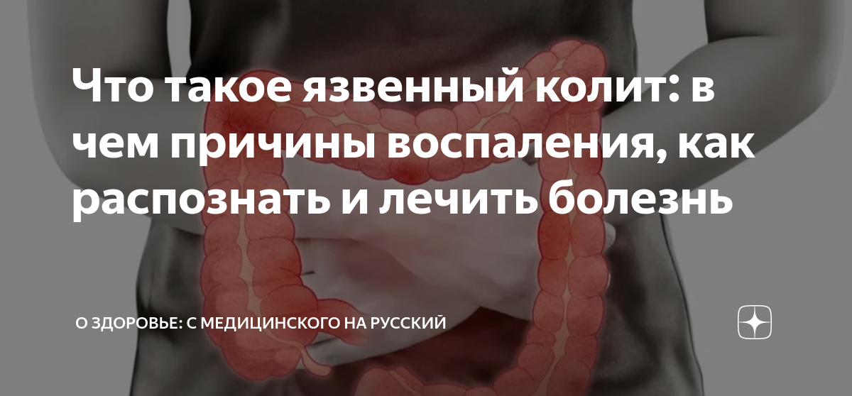 Чем лечить воспаление суставов ног. Боли в ногах от колена до стопы лечение при неврозах - фото презентация РАСТВОР, КОТОРЫЙ ВЫТЯНЕТ ИЗ НОГ ВСЮ БОЛЬ! – Простые советы | Здоровье. Под ногтем воспаление: лечение, причины и диагностика воспаления.