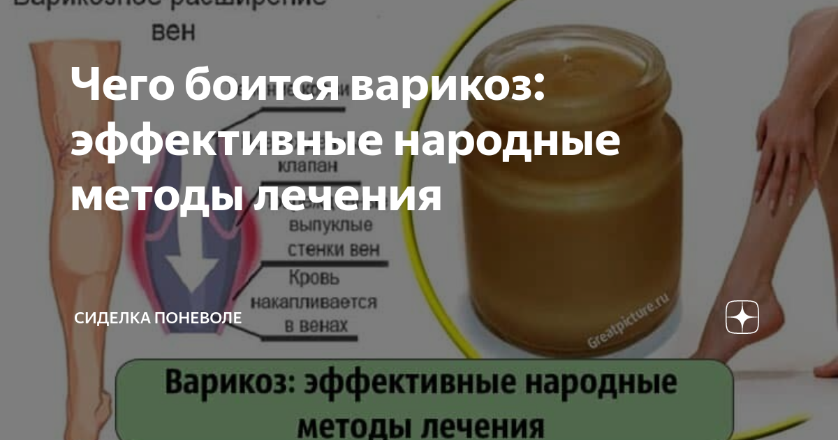 Чего боится варикоз: эффективные народные методы лечения