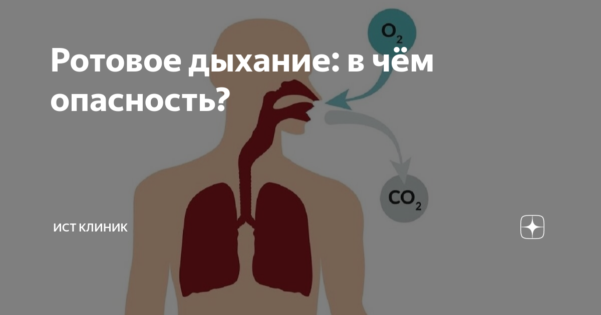 Ротовое дыхание: в чём опасность? | Ист Клиника - неврология, ортопедия ...