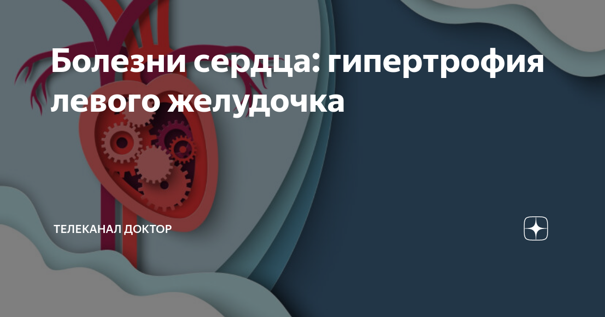 Болезни сердца: гипертрофия левого желудочка | ТЕЛЕКАНАЛ ДОКТОР | Дзен