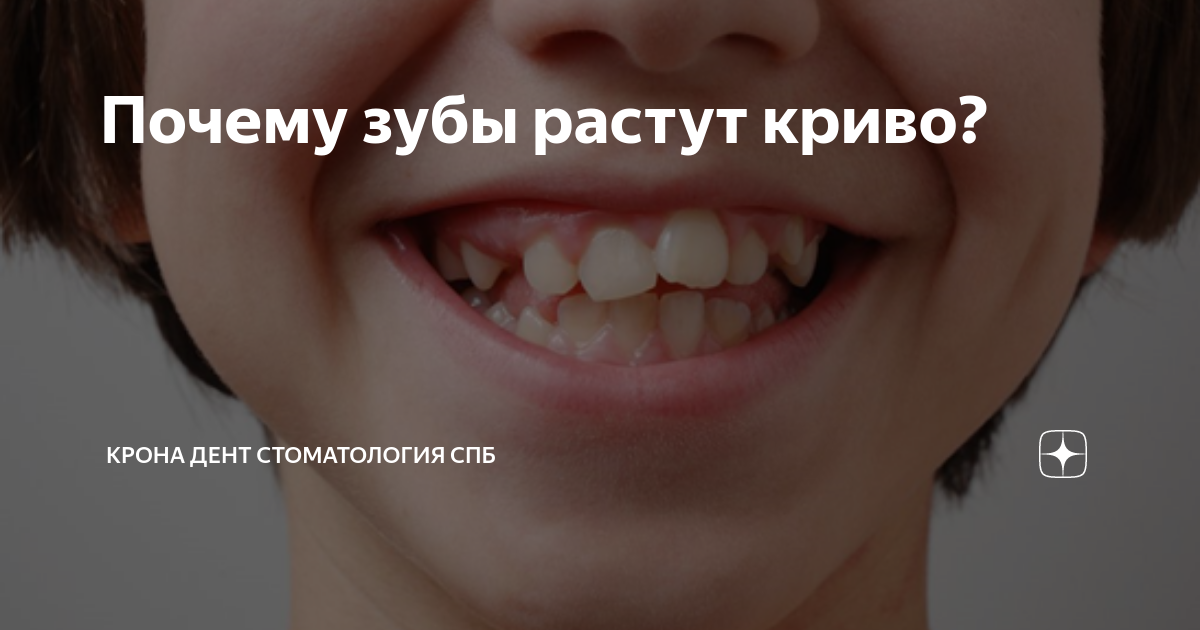 Растить зубы. Почему зубы растут криво.