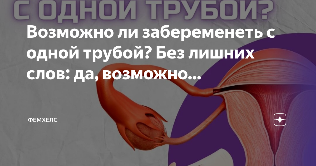 Можно забеременеть с одной трубой. Можно забеременеть с одной трубой