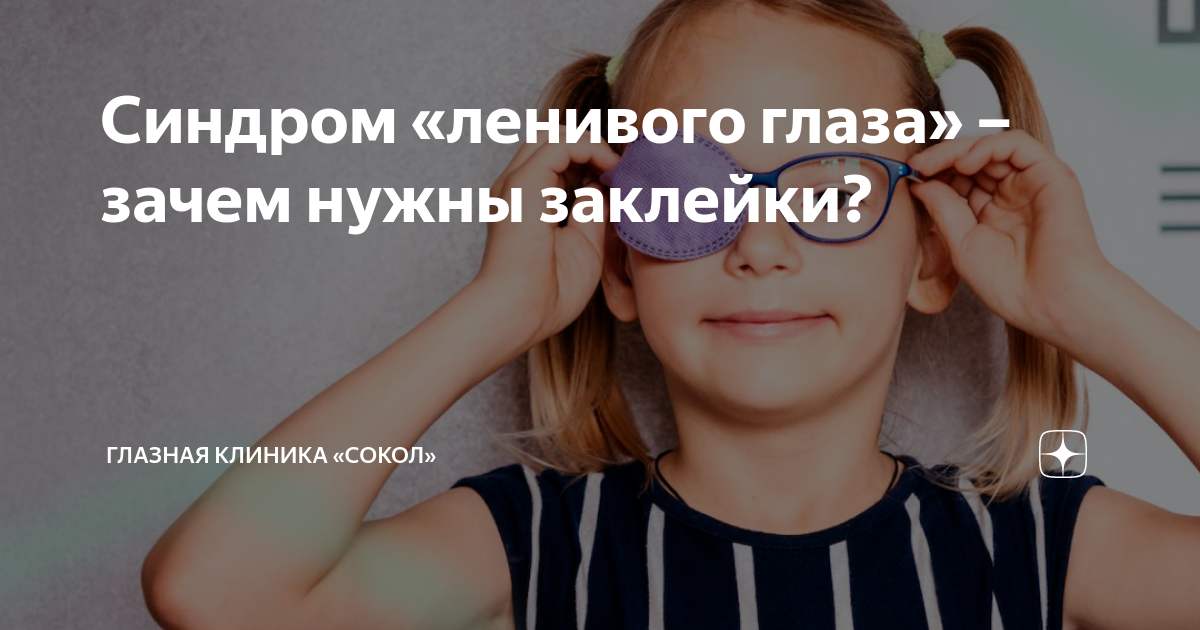 Синдром «ленивого глаза» – зачем нужны заклейки? | Офтальмологический ...