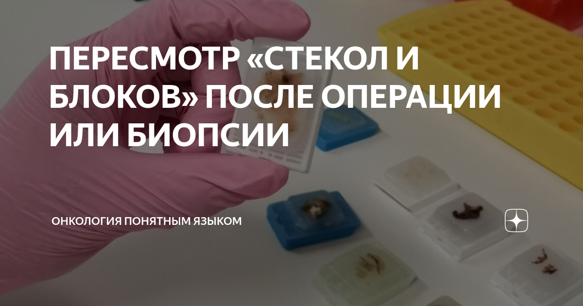 Пересмотр стекол гистология ошибки. Пересмотр стекол гистология ошибки
