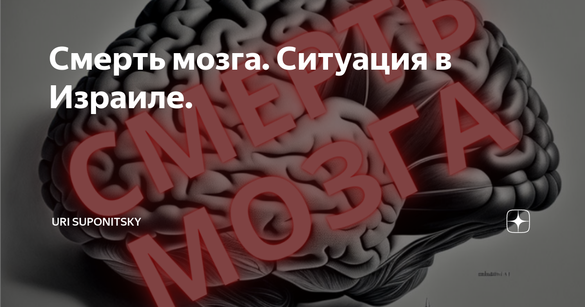 Смерть мозга. Ситуация в Израиле. | Uri Suponitsky | Дзен
