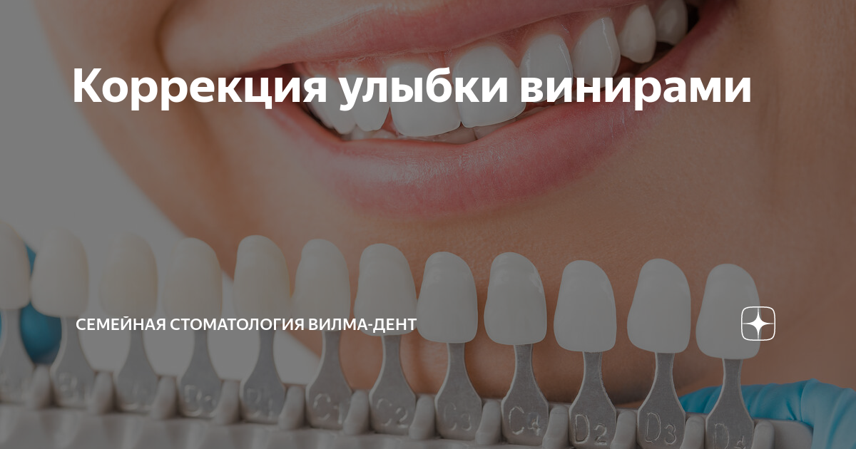 Коррекция smile clinicaspectr ru. Форма зуба стоматология. Виниры схема установки.