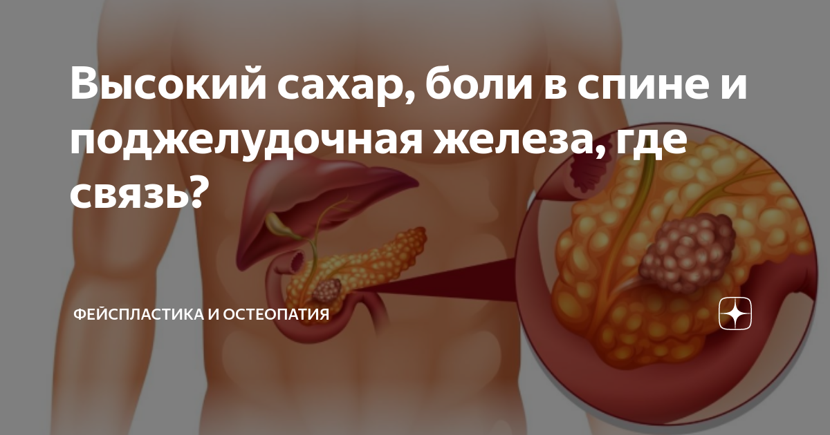 повышенный сахар и суставы