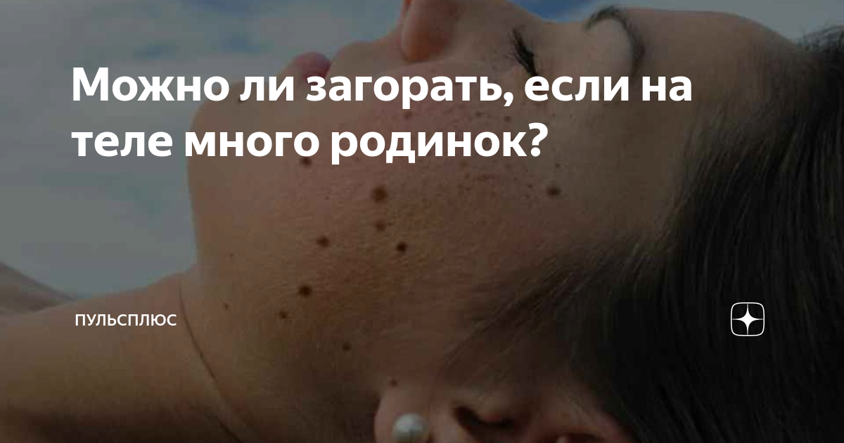 Можно ли загорать, если на теле много родинок? | ПульсПлюс | Дзен