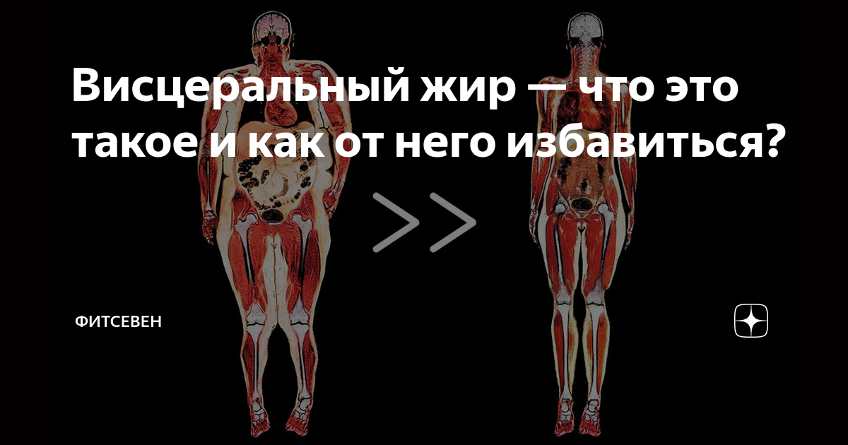 висцеральный жир на животе как убрать