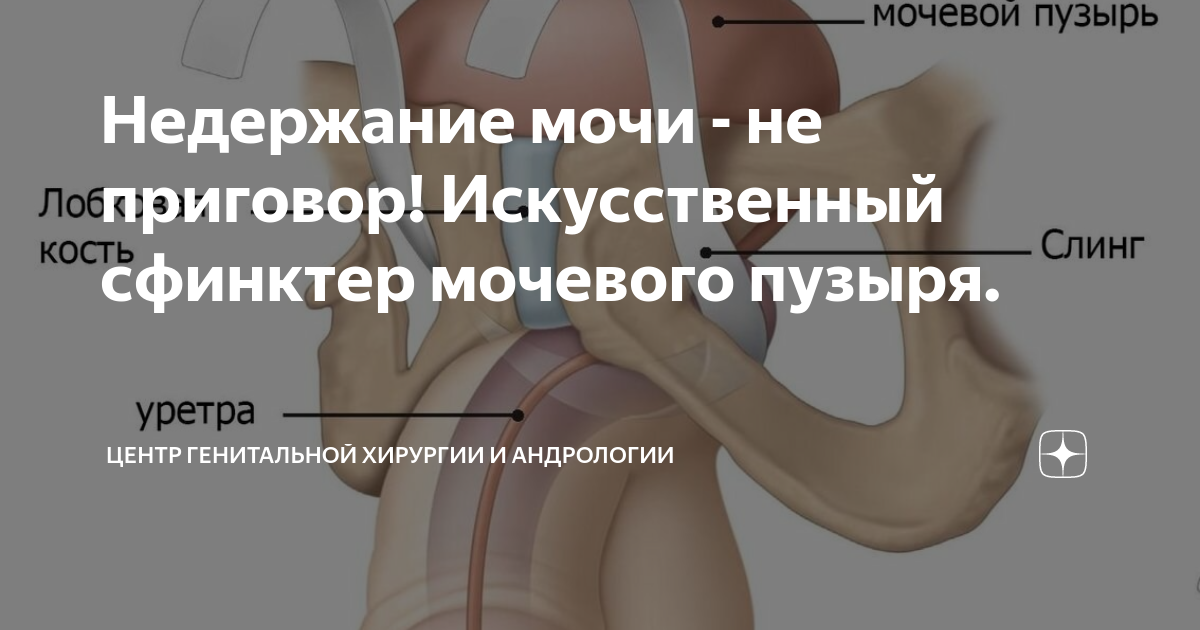 мужской мочеиспускательный канал имеет сфинктеры