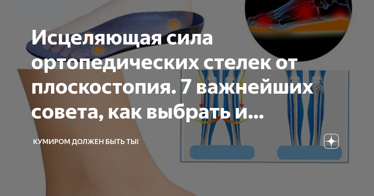 Плоскостопие презентация ортопедия