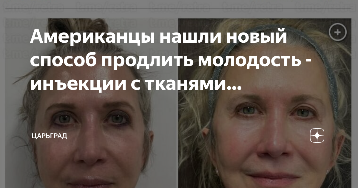 Американцы нашли новый способ продлить молодость - инъекции с тканями