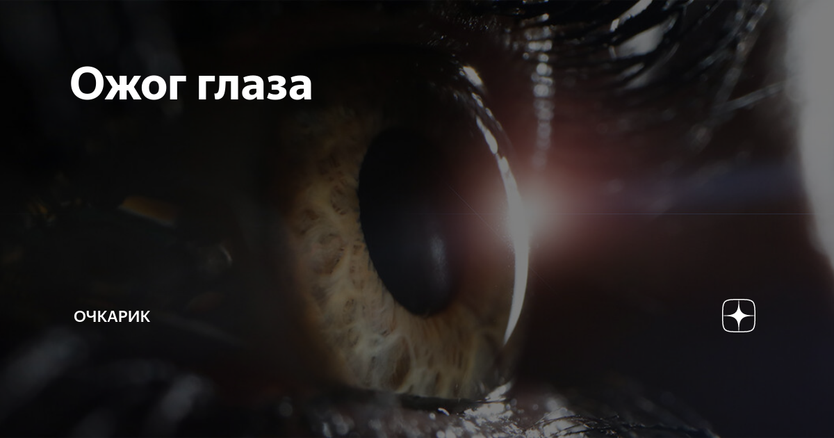 Ожоги глаз: как правильно оказать первую помощь? "Ochkov.net"