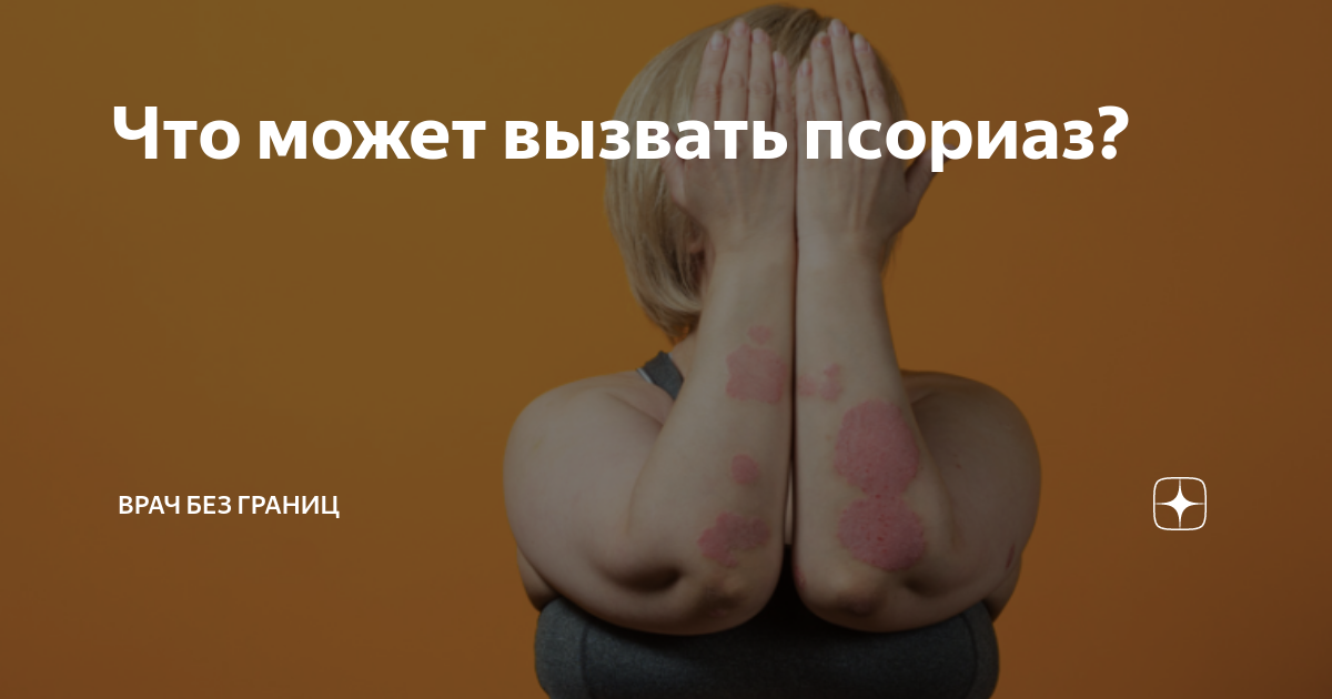 псориаз по всему телу что делать
