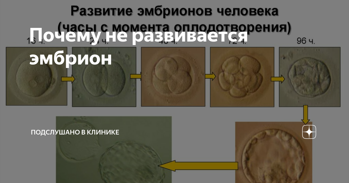 Почему происходит остановка развития эмбрионов?