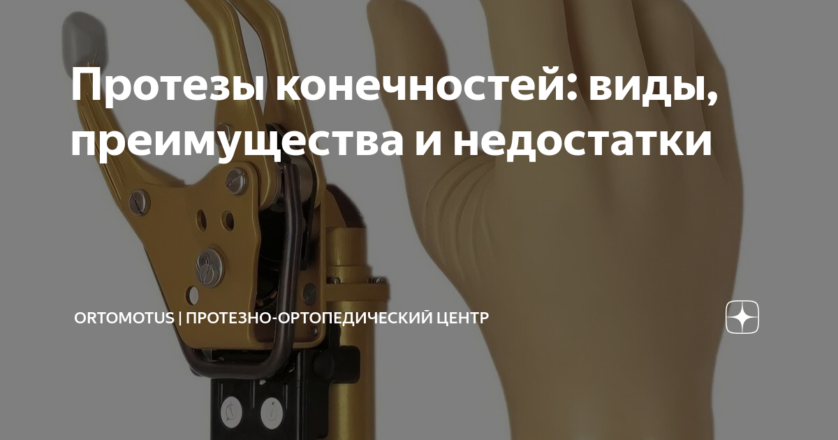 Протезы конечностей: виды, преимущества и недостатки | Ortomotus ...