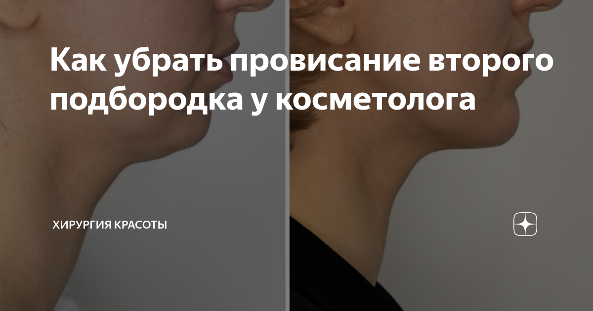 второй подбородок как убрать косметология