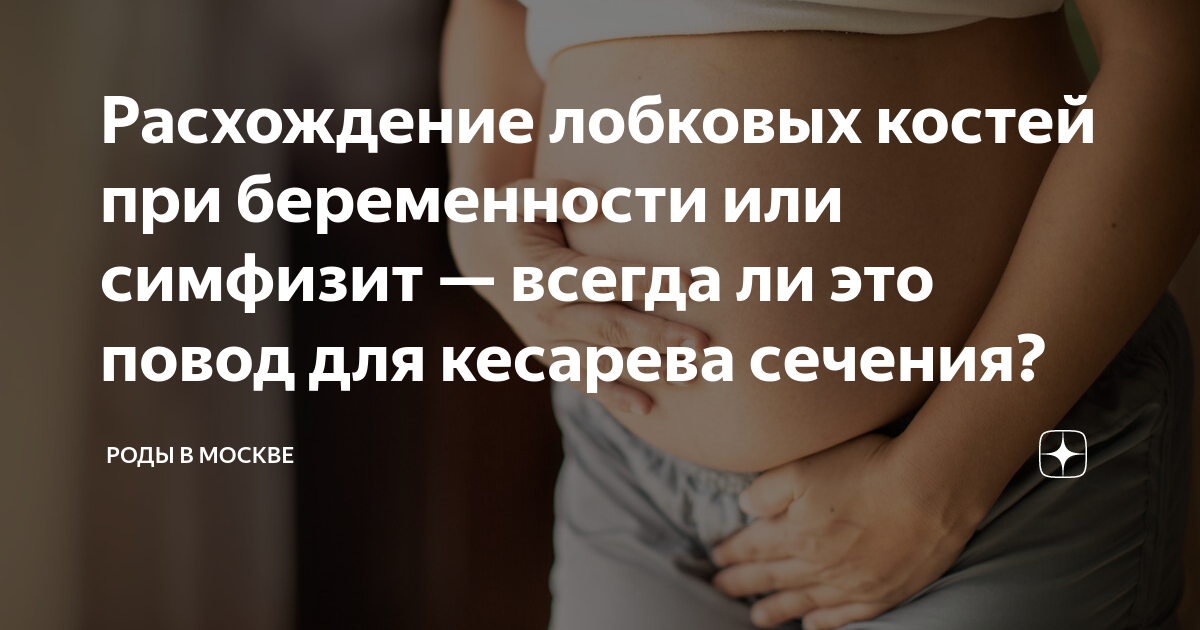 Симфизит при беременности симптомы 2 триместр. Норма симфиза при беременности. Проявление симфизита при беременности. Симфизит при беременности симптомы 2 триместр. Узи лонного сочленения норма.