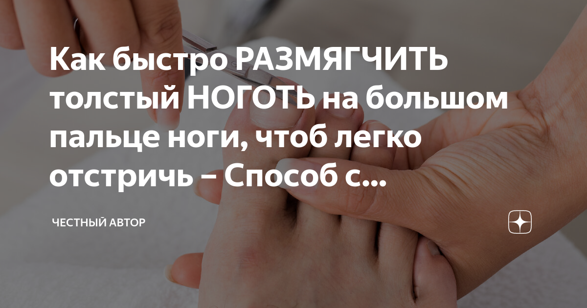 Как быстро размягчить ногти на ногах. Как быстро размягчить ногти на ногах чтобы легче подстричь.