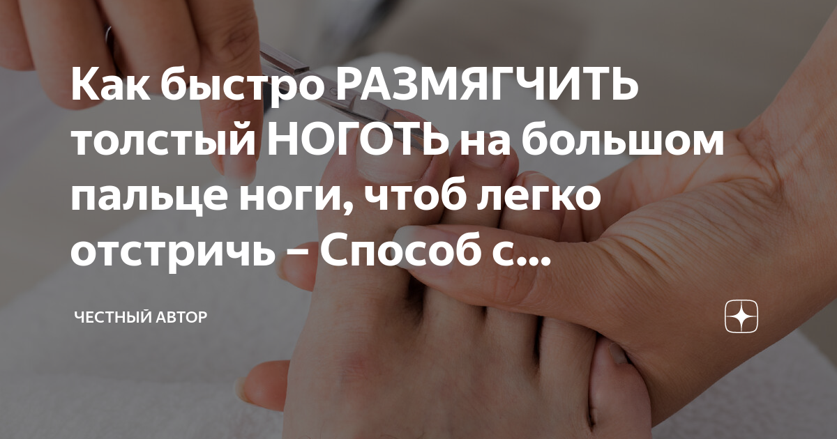 Особенности и лучшие методы для размягчения ногтей