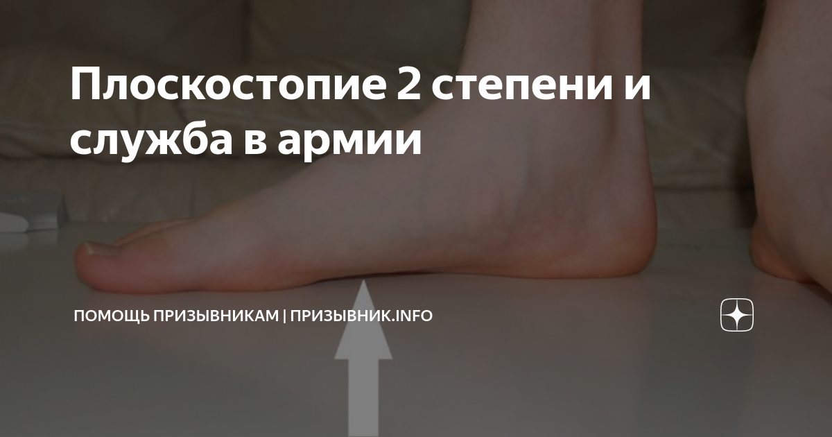 Плоскостопие 2 степени и служба в армии | Помощь призывникам ...