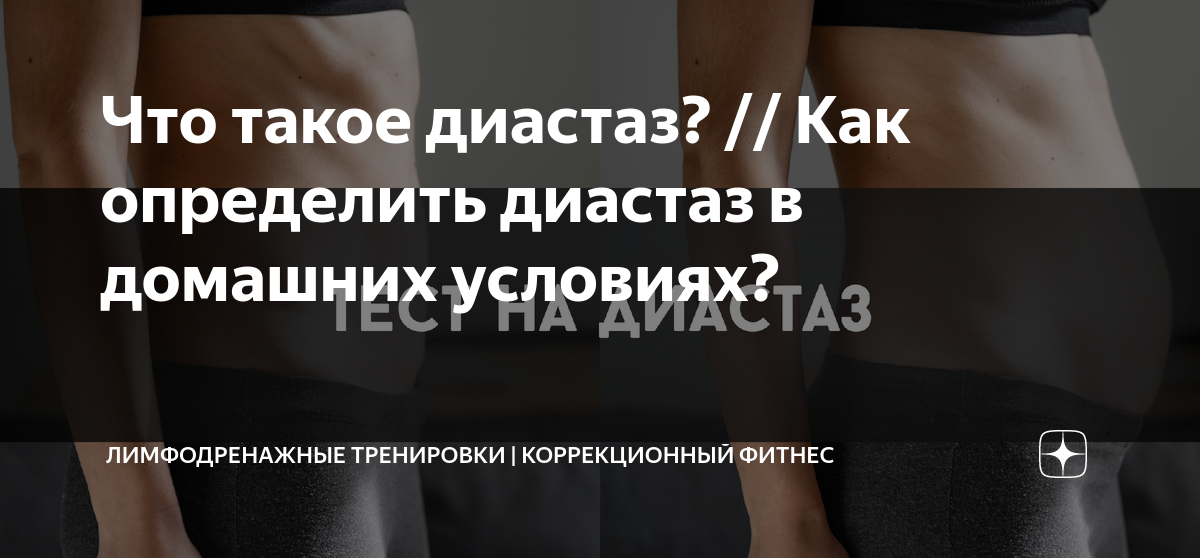 Как самой определить диастаз живота после родов? Самодиагностика расхождения мышц. Тест на проверку